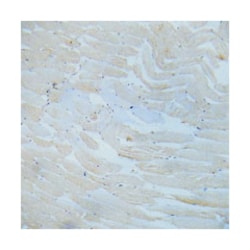 IKK-alpha/beta Rabbit anti-Human, Mouse, Rat, Polyclonal Antibody, Abnova