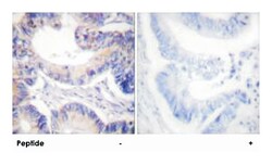 ACACA Rabbit anti-Human, Mouse, Rat, Polyclonal Antibody, Abnova 100&mu;g;