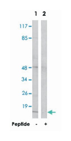 RPS12 Rabbit anti-Human, Mouse, Rat, Polyclonal Antibody, Abnova 100 &mu;g | Buy Online | Abnova Corporation | Fisher Scientific