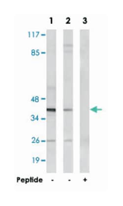 NT5C1A, Rabbit, Polyclonal Antibody, Abnova 100 &mu;g | Buy Online | Abnova Corporation | Fisher Scientific