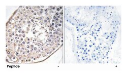 DNAL4, Rabbit, Polyclonal Antibody, Abnova 100 &mu;g | Buy Online | Abnova | Fisher Scientific