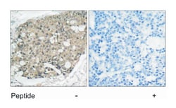 AKT1 Rabbit anti-Human, Mouse, Rat, Polyclonal Antibody, Abnova 100 &mu;g | Buy Online | Abnova | Fisher Scientific