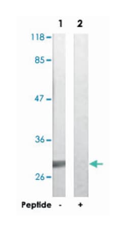 TNNI3 Rabbit anti-Human, Mouse, Rat, Polyclonal Antibody, Abnova 100 &mu;g | Buy Online | Abnova | Fisher Scientific