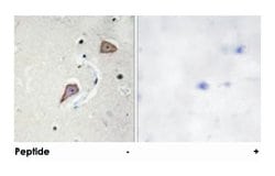 ERBB2 Rabbit anti-Human, Polyclonal Antibody, Abnova 100&mu;g; Unlabeled:Antibodies,