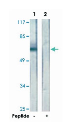 MSN, Rabbit, Polyclonal Antibody, Abnova 100&mu;g; Unlabeled:Anticuerpos