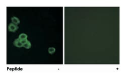 CAMK2A/CAMK2D, Rabbit, Polyclonal Antibody, Abnova 100&mu;g; Unlabeled:Antibodies,
