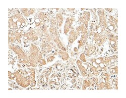 AKR7A2, Rabbit, Polyclonal Antibody, Abnova 100&mu;g; Unlabeled:Antibodies,