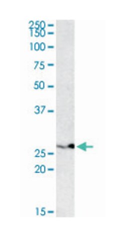 PSMB4 Goat anti-Human, Polyclonal Antibody, Abnova 100 &mu;g | Buy Online | Abnova Corporation | Fisher Scientific