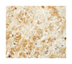 ATP2C1, Rabbit, Polyclonal Antibody, Abnova 100&mu;g; Unlabeled:Antibodies,