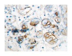 CXCL10 Rabbit anti-Human, Polyclonal Antibody, Abnova 100&mu;g; Unlabeled:Antibodies,