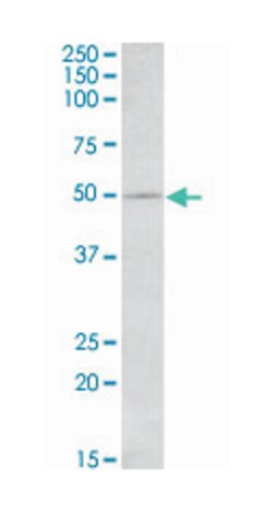 IL7R, Goat, Polyclonal Antibody, Abnova 100&mu;g; Unlabeled:Antibodies,