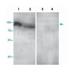 ADCY3, Rabbit, Polyclonal Antibody, Abnova 100&mu;g; Unlabeled:Antibodies,