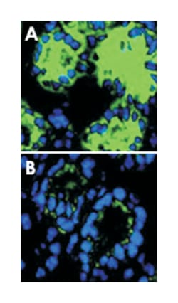 Il18 Rabbit anti-Mouse, Polyclonal Antibody, Abnova 500&mu;g; Unlabeled:Antibodies,