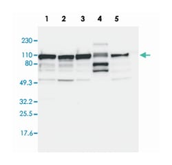 CTAGE5 Rabbit anti-Human, Polyclonal Antibody, Abnova 100 &mu;L | Buy Online | Abnova Corporation | Fisher Scientific