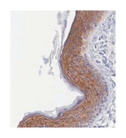 ZNF185 Rabbit anti-Human, Polyclonal Antibody, Abnova 100&mu;L; Unlabeled:Antibodies,