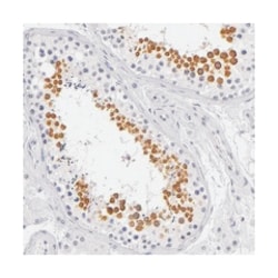 FAM181A, Rabbit, Polyclonal Antibody, Abnova 100&mu;L; Unlabeled:Antibodies,