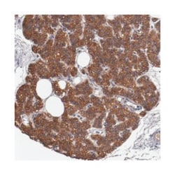 DNAAF2 Rabbit anti-Human, Polyclonal Antibody, Abnova 100 &mu;L | Buy Online | Abnova | Fisher Scientific