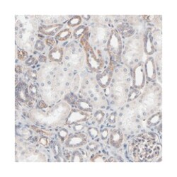 ABCD4, Rabbit, Polyclonal Antibody, Abnova 100&mu;L; Unlabeled:Antibodies,
