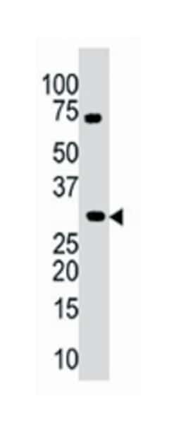 PIM3, Rabbit, Polyclonal Antibody, Abnova 400 &mu;L | Buy Online | Abnova Corporation | Fisher Scientific