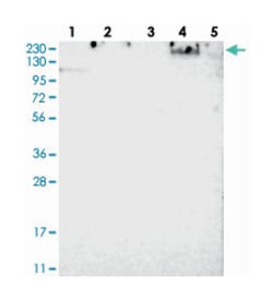 SPTBN1 Rabbit anti-Human, Polyclonal Antibody, Abnova 100&mu;L; Unlabeled:Antibodies,