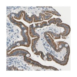 MGC3196, Rabbit, Polyclonal Antibody, Abnova 100 &mu;L | Buy Online | Abnova Corporation | Fisher Scientific