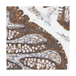 TMTC4, Rabbit, Polyclonal Antibody, Abnova 100&mu;L; Unlabeled:Antibodies,
