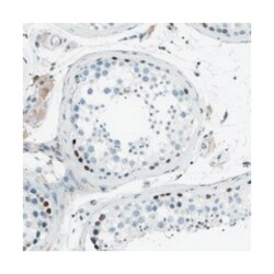 ZBTB43, Rabbit, Polyclonal Antibody, Abnova 100&mu;L; Unlabeled:Antibodies,