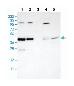 CCDC104 Rabbit anti-Human, Polyclonal Antibody, Abnova 100 &mu;L | Buy Online | Abnova | Fisher Scientific