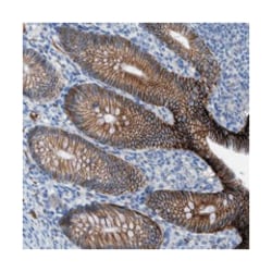 CNNM4, Rabbit, Polyclonal Antibody, Abnova 100 &mu;L | Buy Online | Abnova Corporation | Fisher Scientific