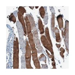 RWDD2B, Rabbit, Polyclonal Antibody, Abnova 100 &mu;L | Buy Online | Abnova Corporation | Fisher Scientific