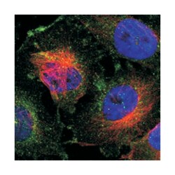 DYNLT3, Rabbit, Polyclonal Antibody, Abnova 100 &mu;L | Buy Online | Abnova Corporation | Fisher Scientific