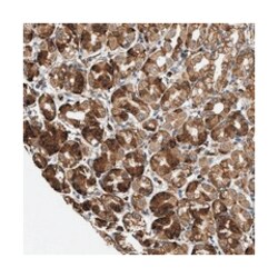 MUM1L1 Rabbit anti-Human, Polyclonal Antibody, Abnova 100 &mu;L | Buy Online | Abnova Corporation | Fisher Scientific