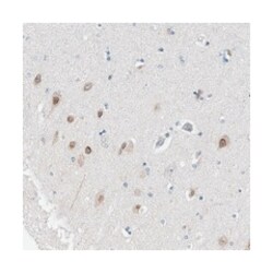 LRCH1, Rabbit, Polyclonal Antibody, Abnova 100 &mu;L | Buy Online | Abnova Corporation | Fisher Scientific