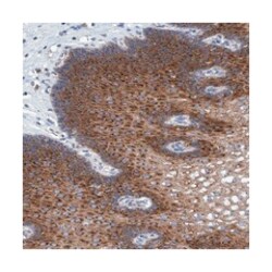 BICD2 Rabbit anti-Human, Polyclonal Antibody, Abnova 100 &mu;L | Buy Online | Abnova Corporation | Fisher Scientific