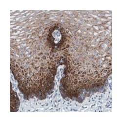 R3HCC1 Rabbit anti-Human, Polyclonal Antibody, Abnova 100 &mu;L | Buy Online | Abnova Corporation | Fisher Scientific