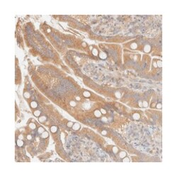FAM167A Rabbit anti-Human, Polyclonal Antibody, Abnova 100 &mu;L | Buy Online | Abnova Corporation | Fisher Scientific