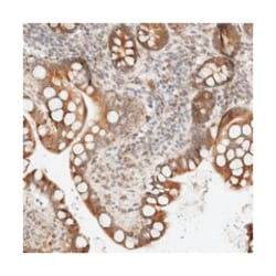 CCDC129, Rabbit, Polyclonal Antibody, Abnova 100 &mu;L | Buy Online | Abnova Corporation | Fisher Scientific