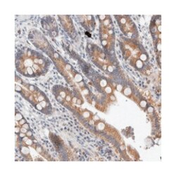 MRPL37 Rabbit anti-Human, Polyclonal Antibody, Abnova 100 &mu;L | Buy Online | Abnova Corporation | Fisher Scientific