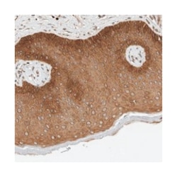 ARMC9 Rabbit anti-Human, Polyclonal Antibody, Abnova 100 &mu;L | Buy Online | Abnova Corporation | Fisher Scientific