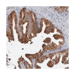 SLC25A22, Rabbit, Polyclonal Antibody, Abnova 100 &mu;L | Buy Online | Abnova | Fisher Scientific