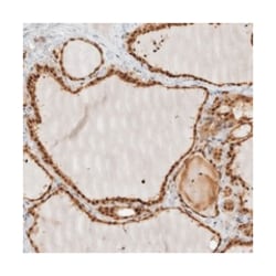 ADPRHL2 Rabbit anti-Human, Mouse, Rat, Polyclonal Antibody, Abnova 100 &mu;L | Buy Online | Abnova Corporation | Fisher Scientific