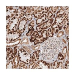 C1orf109 Rabbit anti-Human, Polyclonal Antibody, Abnova 100 &mu;L | Buy Online | Abnova Corporation | Fisher Scientific