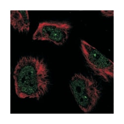 C1orf114 Rabbit anti-Human, Polyclonal Antibody, Abnova 100 &mu;L | Buy Online | Abnova Corporation | Fisher Scientific