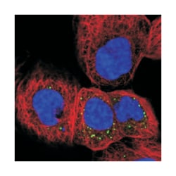 PHLDA3, Rabbit, Polyclonal Antibody, Abnova 100&mu;L; Unlabeled:Antibodies,