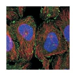 SORBS1, Rabbit, Polyclonal Antibody, Abnova 100 &mu;L | Buy Online | Abnova Corporation | Fisher Scientific