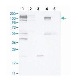 CGN Rabbit anti-Human, Polyclonal Antibody, Abnova 100&mu;L; Unlabeled:Antibodies,