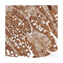 BAT2D1 Rabbit anti-Human, Polyclonal Antibody, Abnova 100 &mu;L | Buy Online | Abnova Corporation | Fisher Scientific
