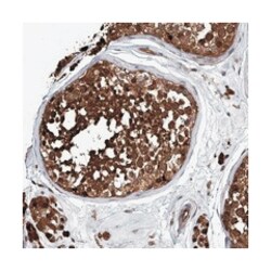PSMB1 Rabbit anti-Human, Mouse, Rat, Polyclonal Antibody, Abnova 100 &mu;L | Buy Online | Abnova Corporation | Fisher Scientific