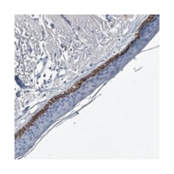 TTC24 Rabbit anti-Human, Polyclonal Antibody, Abnova 100 &mu;L | Buy Online | Abnova Corporation | Fisher Scientific