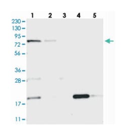 MTO1 Rabbit anti-Human, Polyclonal Antibody, Abnova 100&mu;L; Unlabeled:Antibodies,